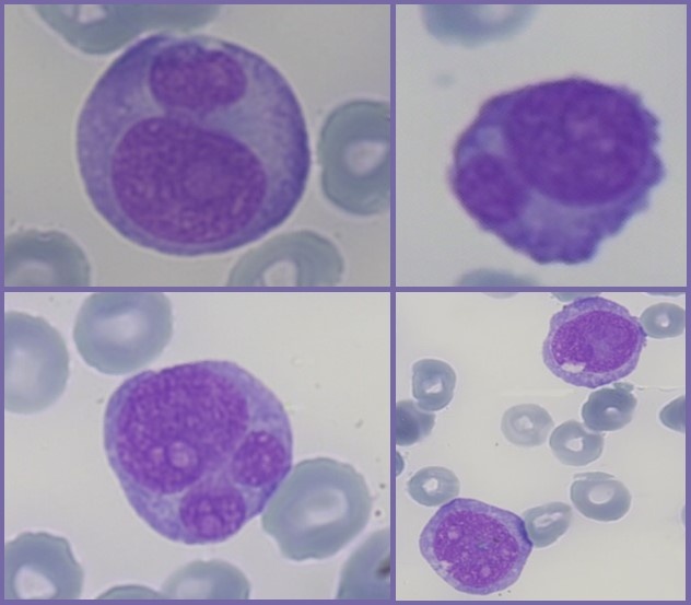 Nueva imagen de interés de citología sanguínea